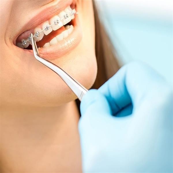 ابزار ارتودنسی