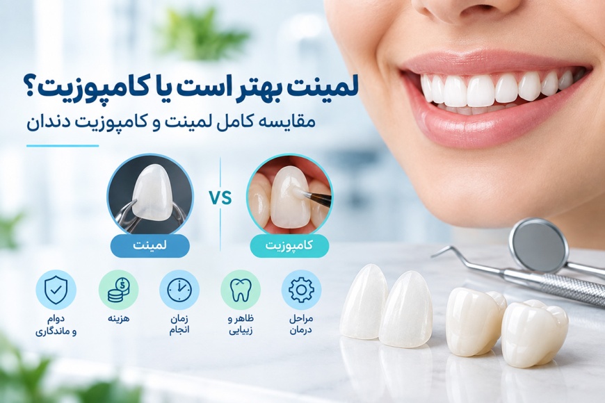 لمینت بهتر است یا کامپوزیت؟ مقایسه کامل لمینت و کامپوزیت دندان