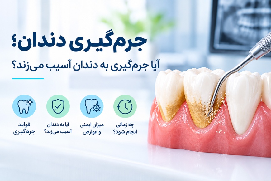 جرم‌گیری دندان؛ آیا جرم‌گیری به دندان آسیب می‌زند؟